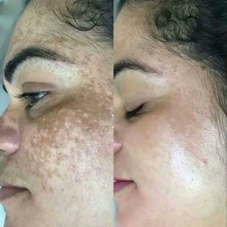 صابون چند کاره بیوممتیک دست و صورت زردچوبه دکتربیز برای رفع تیرگی -رفع لک و اکنه -درمان جوش-شفافیت-رطوبت رسان پک سه عددی