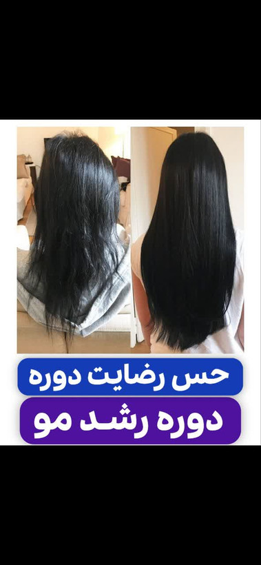 خرید قسطی تونیک ضد ریزش و و رویش مجدد مو دوقلو برند اکسونیک-سوئیس