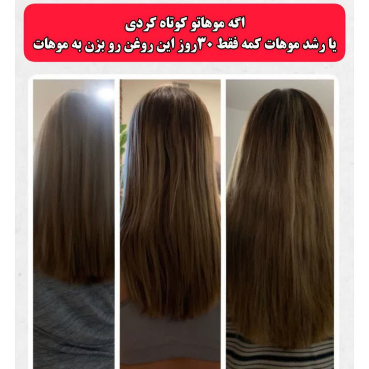 خرید قسطی تونیک ضد ریزش و و رویش مجدد مو دوقلو برند اکسونیک-سوئیس