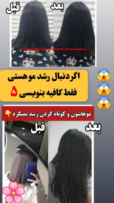 خرید قسطی تونیک ضد ریزش و و رویش مجدد مو دوقلو برند اکسونیک-سوئیس