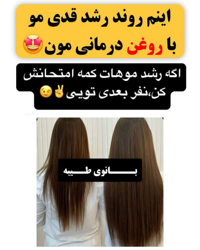 خرید قسطی تونیک ضد ریزش و و رویش مجدد مو دوقلو برند اکسونیک-سوئیس(قسطی تعداد۲عدد)