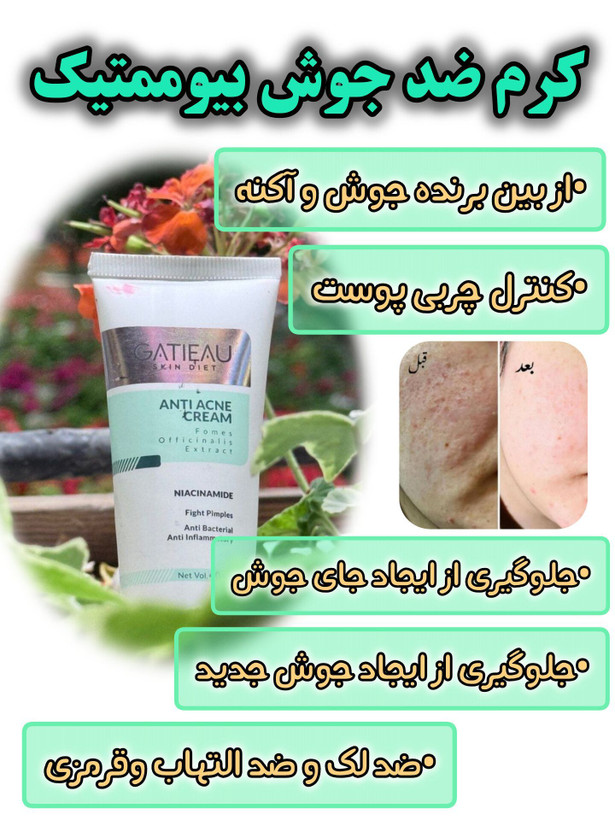 کرم بیوممتیک ضد لک 4 کاره گاتیو ایتالیا 40میل(قسطی تعداد۲عدد)