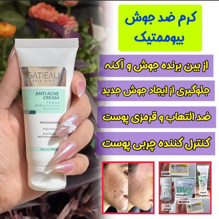 کرم بیوممتیک ضد لک 4 کاره گاتیو ایتالیا 40میل(قسطی تعداد۲عدد)